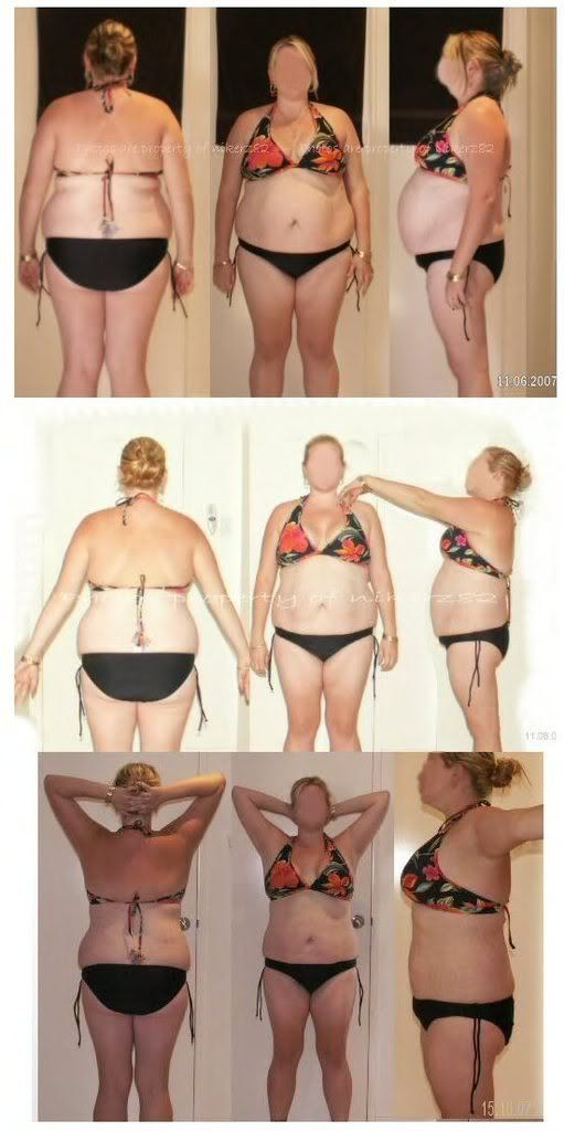 Nude before and after weight loss pics - Sex archive.