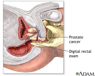 Pretty S. reccomend Prostate gland orgasm