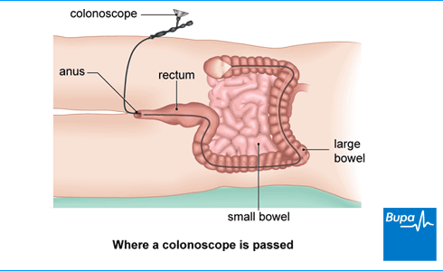 best of The Colonoscope anus and it introduced through