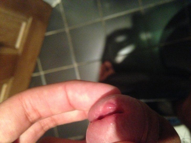 Penis hole red and swollen