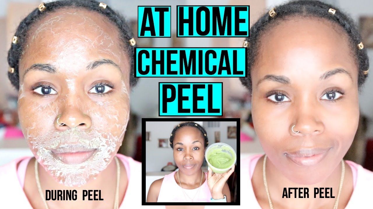 Winger reccomend Make your own facial peel