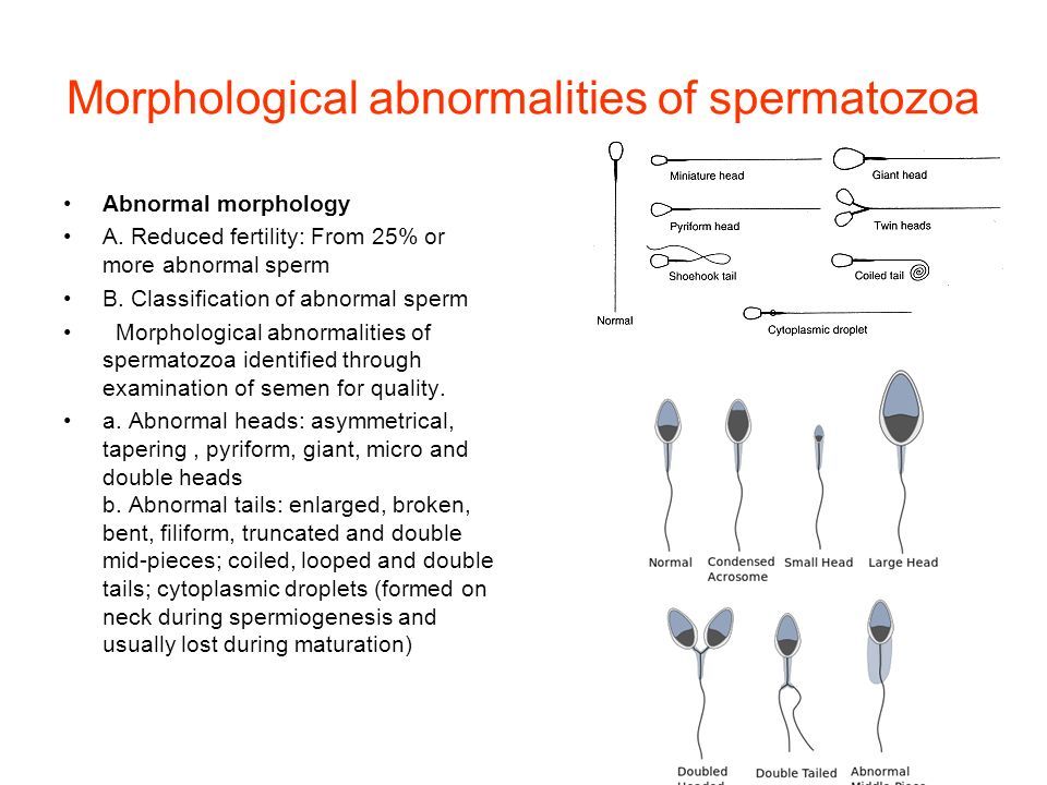 best of Tails sperm Abnormal on