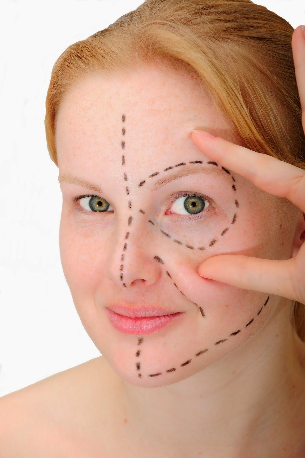 Blogspotcom facial plastic site surgery