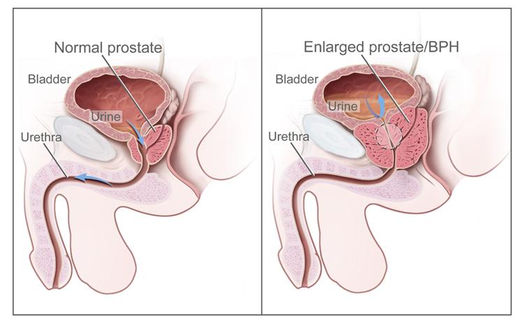 best of Orgasm Prostate gland