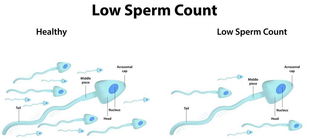 Shadow reccomend Sperm count for fertility
