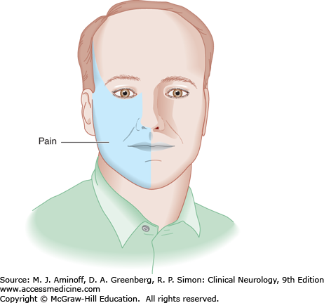Facial neuropathy forehead