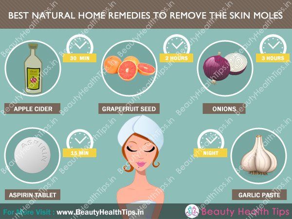 Home remedies on facial mole removal