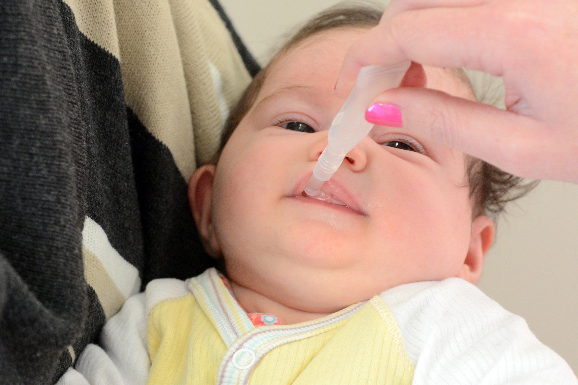 Gem reccomend Infant severe facial rash anaphylaxis