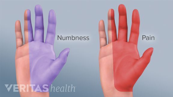 Numbness in left hand thumb