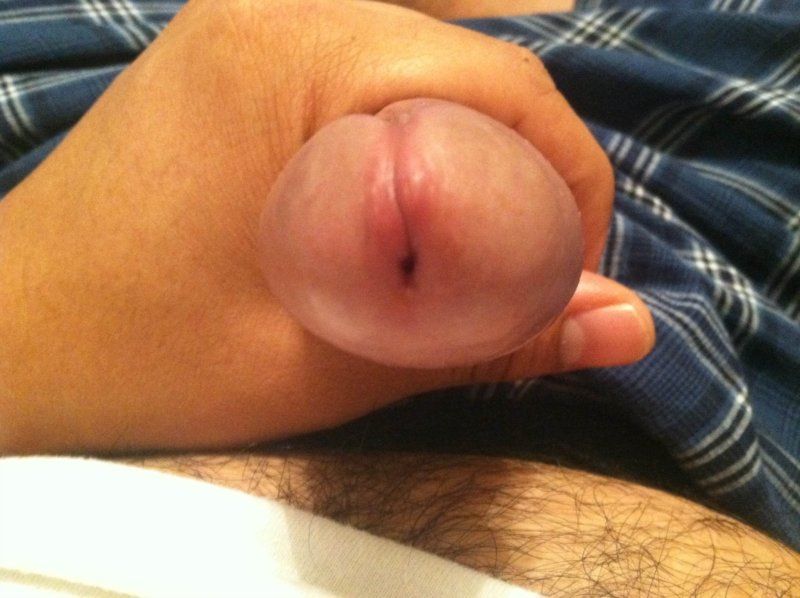 Penis hole red and swollen